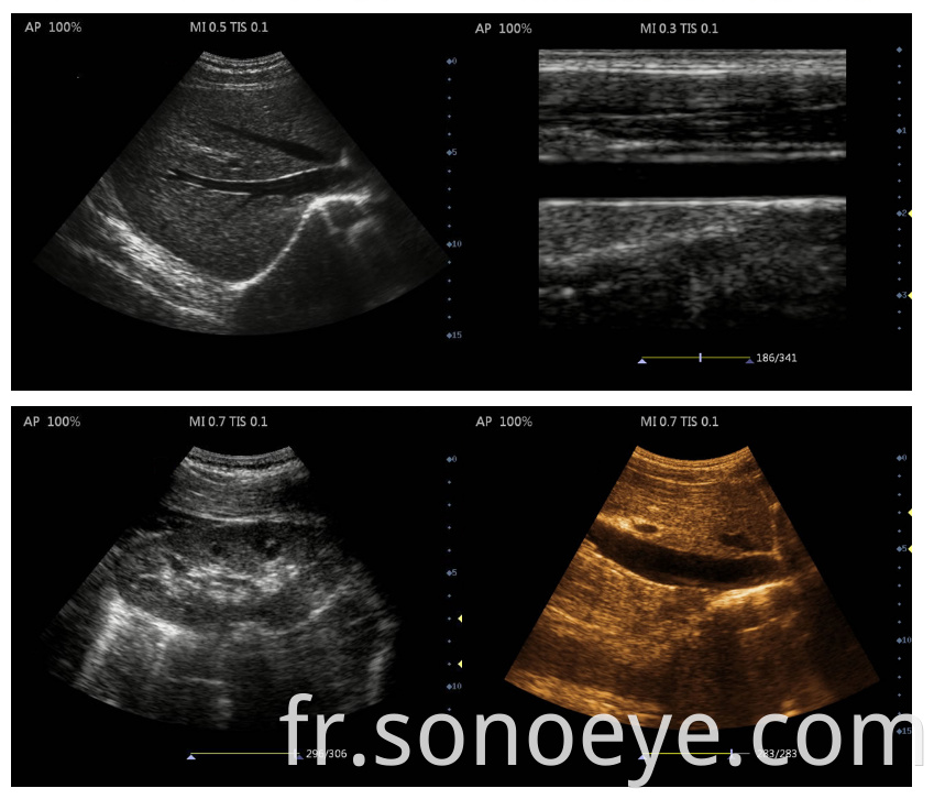 ultrasound machine laptop for Clinic